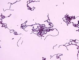 Image result for Group D Streptococcus