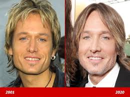 Keith urban is famous for his signature shaggy hairstyle, but it appears. Keith Urban Good Genes Or Good Docs