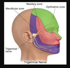 A migraine is usually a moderate to severe throbbing headache often on one side of the head, and accompanied by other. Headaches And Dizziness Physiopedia