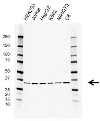 Check spelling or type a new query. Anti Prkra Antibody Clone Ab01 1c8 Precisionab Monoclonal Antibody Bio Rad