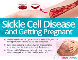 Your doctor will recommend you have extra tests to beta thalassaemia major makes pregnancy complications more likely (nice 2017, rcog 2014). Sickle Cell Disease And Getting Pregnant Shecares