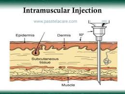 47389949 781756268839019 3843277894855950336 N Nursing Student Tips Injections Nursing School Tips