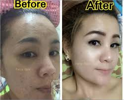 It depends upon manufacturers expenses, cost of production, analysis price, packaging, and dealer's commission and so on. Bee Venom Michiko My Online Store