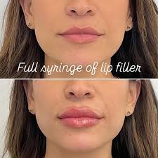 Looking for a simple skincare routine? ✨ Here's Chelsey's simple 4-step  evening skincare lineup: ✔️ Cleanse ✔️ Polish ✔️ Repair ✔️ Treat (with  topical spironolactone) Quick, easy, and glow-inducing. 💙 Everyone's skin