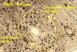 They are obtained by taking imaginary slices perpendicular to the main axis of organs, vessels, nerves, bones, soft tissue. Bone