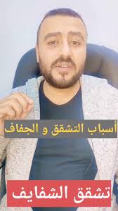 علاج تشقق الشفاه...