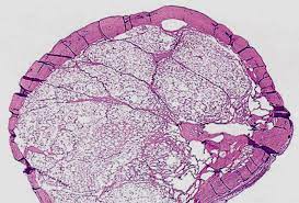 Check spelling or type a new query. Peritoneum And Broad Ligament Springerlink