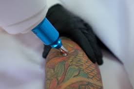 1 count (pack of 1). Best Laser Tattoo Removal Machines To Zap That Tattoo In 2021 Saved Tattoo