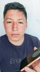 Erick Raymundo (@raymundoerick13)