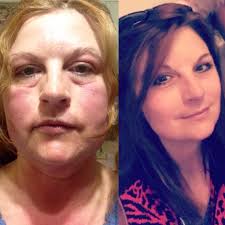 Carnivore diet benefits for over 50 households