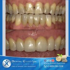 We did not find results for: 10 Best Clinics For Teeth Whitening In Dominican Republic 2021 Prices
