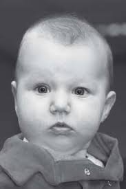 Concept JGZ richtlijn Preventie, signalering en aanpak van voorkeurshouding  en schedelvervorming