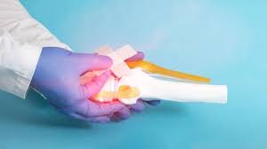 Các bệnh cơ xương khớp thường gặp nhất và cách điều trị