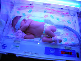 Bayi kuning terjadi karena bilirubin yang dihasilkan lebih banyak dibandingkan dengan yang bisa diolah oleh hati bayi. Kalau Nak Elak Demam Kuning Bayi Lakukan 5 Perkara Ini