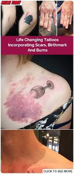 Mole Birthmark Tattoo Cover Up Pin On Sweet Tattoos