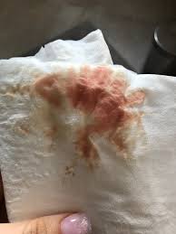 Relying solely on cervical discharge is not an accurate way to determine if you're pregnant. 7 Weeks Bleeding Spotting Help