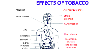 Addiction to tobacco is caused by the presence of. Tobacco Smoking Effects Trivia Quiz Proprofs Quiz