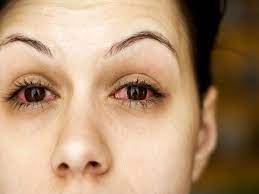 We did not find results for: What Happens If You Sleep With Contacts Boldsky Com