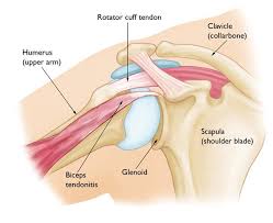 The long head biceps tendon travels through the shoulder joint making it more prone to injury such as a partial tear, rupture. Biceps Tendinitis Orthoinfo Aaos