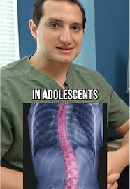 Understanding Scoliosis: Symptoms, Treatment, and Management