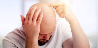 / hair loss information, advice and news from the hair restoration experts at bosley. Why Is My Hair Falling Out In Dubai And How To Cure Euromed Clinic