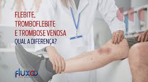 Op welke leeftijd kun je trombose krijgen. Qual A Diferenca Entre Flebite Tromboflebite E Trombose Venosa