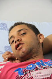 Perro raza Pitbull le mordió los testículos a un hombre en Barranquilla