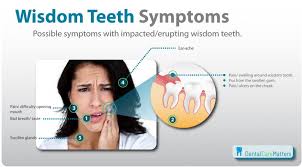 Pin On Teeth Smile Facts