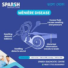 Image result for Inner Ear Decompression Sickness