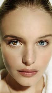 Eyes Like This Either With A Spot Of Different Color Or Heterochromia May Very Well Find Thei Different Colored Eyes Kate Bosworth Eyes Heterochromia Eyes