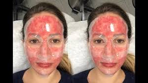 How often should i do micro needling. What Is Microneedling Microneedling Cost Facts And Faqs