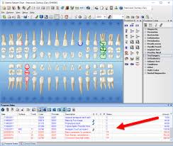 Dentrix Tip Tuesdays Giving Progress Notes A Little Color