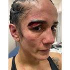 Amanda Serrano after her loss to Katie Taylor : r/ireland