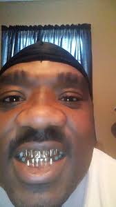 Gold Grills by flocca