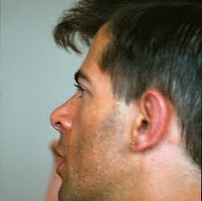 🧀🧀🧀🧀🧀🧀🧀