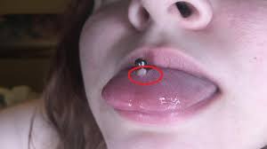You're putting a needle through a muscle but the tongue is one of the fastest healing muscles in your body. How To Get Rid Of A Tongue Piercing Bump Youtube