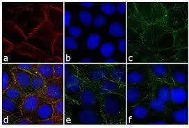 Halotag® alexa fluor® 660 ligand. Goat Anti Rabbit Igg H L Highly Cross Adsorbed Alexa Fluor 660 A 21074
