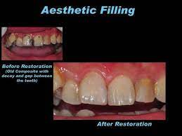 Pin On Dental Images
