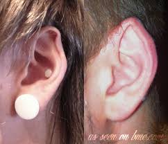 If necessary, you can place an ice pack on the ears, which may help to alleviate pain and reduce swelling, therefore speeding up the recovery period. Ear Pointing Bme Tattoo Piercing And Body Modification News