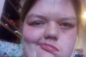 People think I look like a monster, but I just want…