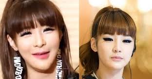 Korean Actress Plastic Surgery Gone Wrong Korean Celebrities Before And After Pl Plastic Surgery Photos Celebrities Before And After Plastic Surgery Gone Wrong
