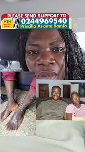 Help Priscilla who’s a kidney patient undergoing dialysis treatment twice a  week and has a brother with special needs... Momo: 024 496 9540