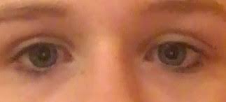 Ein Auge Ist Grosser Augen Gross