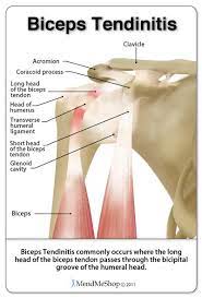 Chapter 26 the biceps tendon wayne z. Pin On Medical Marc