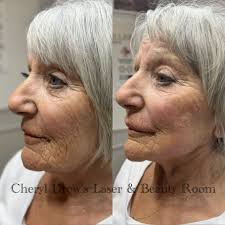 Cheryl Drew's Laser & Beauty Room