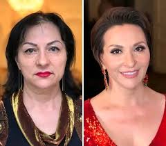 Should I go shorter. Hubby say yes. Says I would look younger. Thoughts?  Brunette in picture