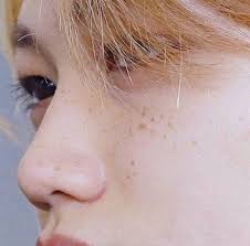 Rita In 2020 Felix Stray Kids Freckles Felix