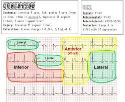 E2fe2ced8dd1794f119717a45162d5b1 Jpg 640 522 Pixels Icu Nursing Cardiac Nursing Nursing Notes