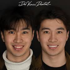 Da Vinci Dental Bellevue