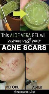 Pin On Skin Treatments